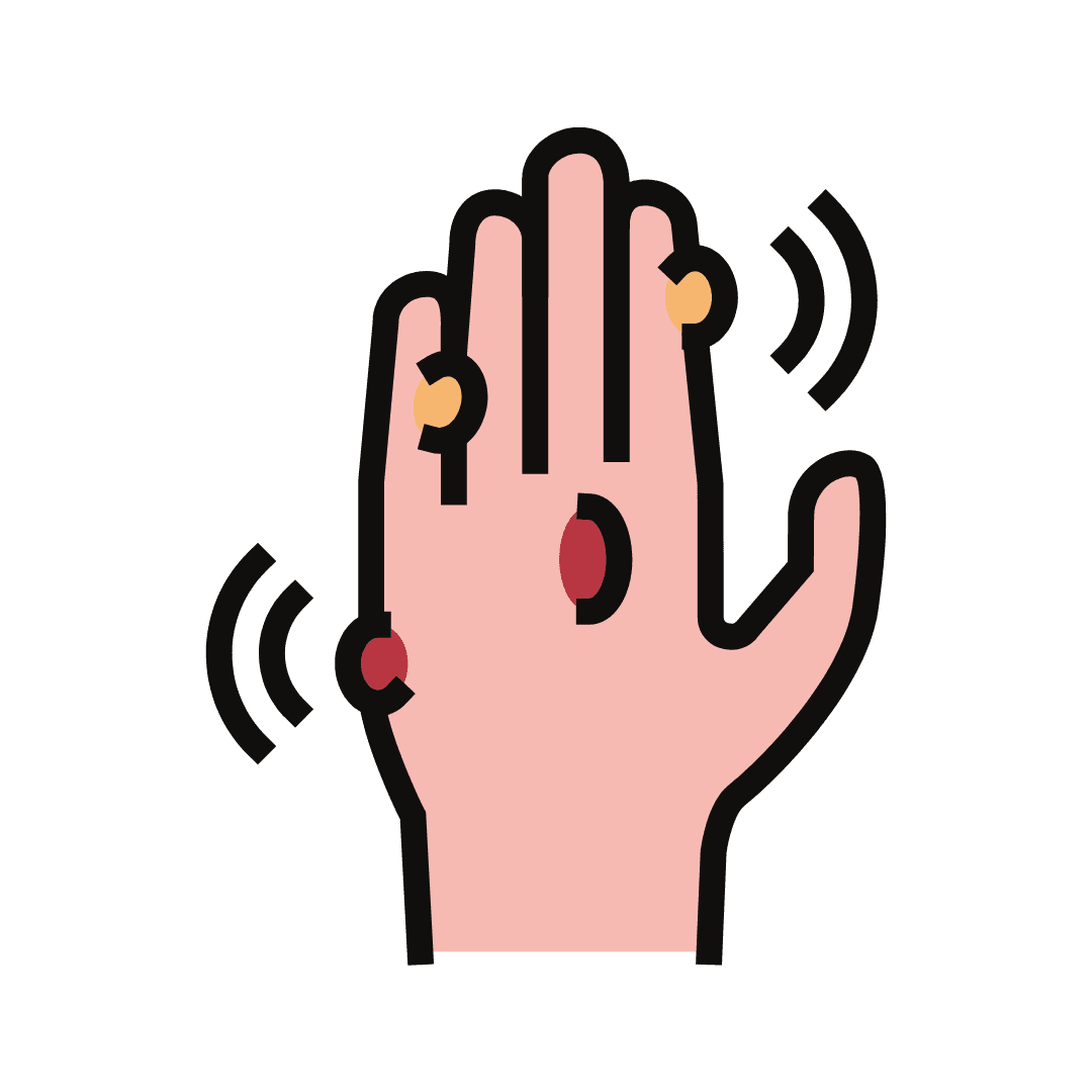 Бородавки и папилломы 