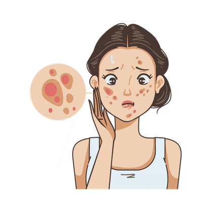 Акне и постакне