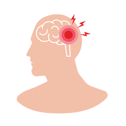 Инсульт (поддержка в восстановлении)